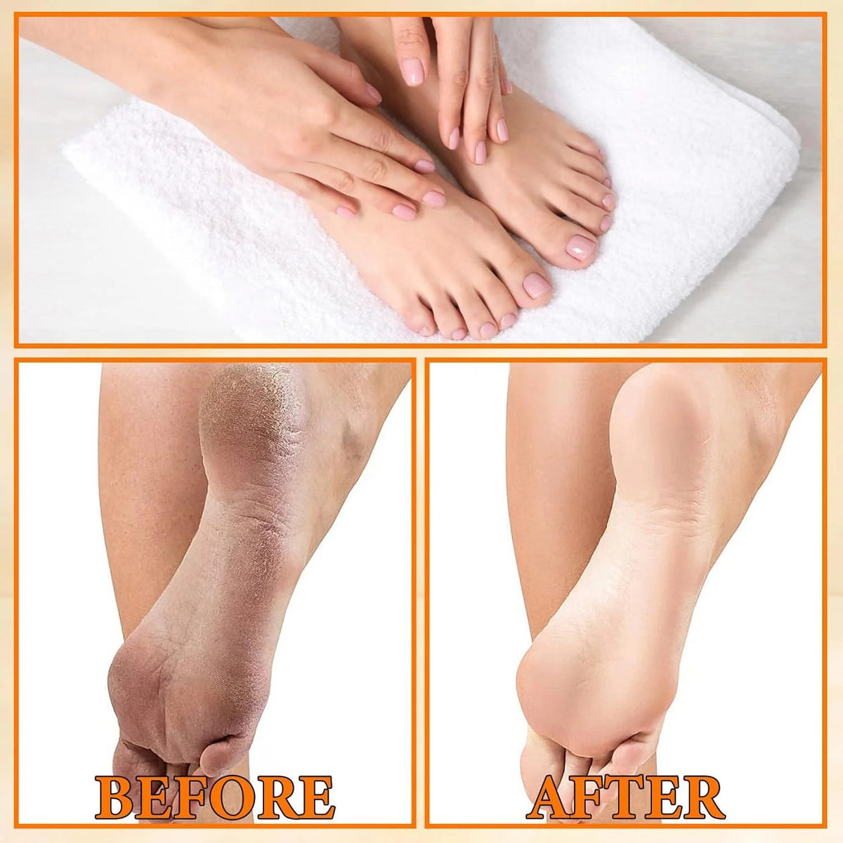 Eelhoe Foot Peeling Spray